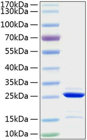 Recombinant Human Bcl-2 Protein