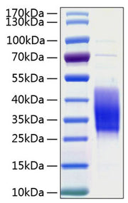 Recombinant Human TIM-3/HAVCR2/CD366 Protein