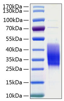Recombinant Human TIM-3/HAVCR2/CD366 Protein