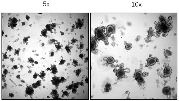 Recombinant Human R-spondin-1/RSPO1 Protein