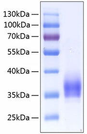 Recombinant Human IL-2RA/CD25 Protein