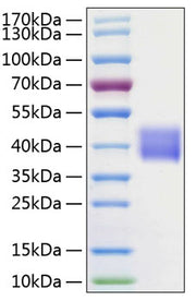 Recombinant Human Kallikrein-1/KLK1 Protein
