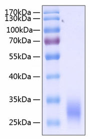 Recombinant Human Fc gamma RIIA/FCGR2A/CD32a (H167R) Protein