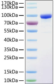 Recombinant Human sTfR/CD71 Protein