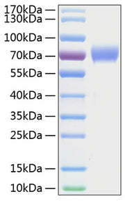 Recombinant Human Tyrosine-protein kinase receptor UFO/Axl Protein