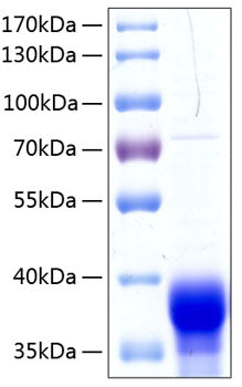 Recombinant Human Ephrin-B1/EFNB1 Protein