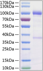 Recombinant Human GDNFR-alpha-1/GFRA1 Protein