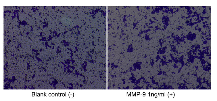 Recombinant Human MMP-9 Protein