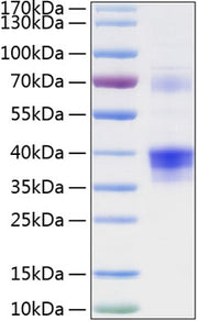 Recombinant Human Clusterin/Apo-J/CLU Protein