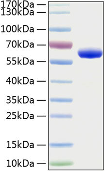 Recombinant Human Erythropoietin R/EPO-R Protein