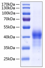 Recombinant Human Lung surfactant protein D/SFTPD(E22G) Protein