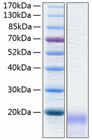 Recombinant Human CEACAM3/CD66d Protein