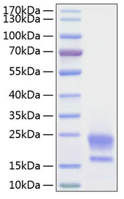 Recombinant Human WAP5/WFDC2/HE4 Protein