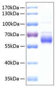 Recombinant Human FGFR-5/FGFRL1 Protein