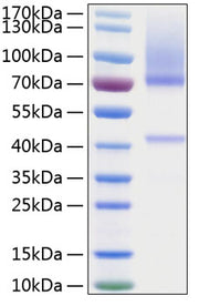Recombinant Human Glypican-3/GPC3 Protein