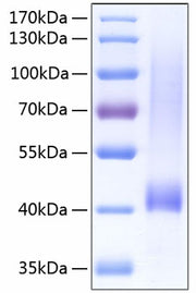 Recombinant Human Biglycan/BGN Protein