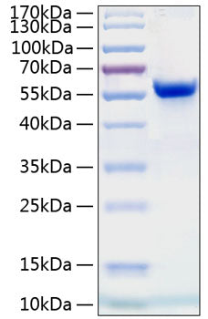 Recombinant Human Ephrin-A4/EFNA4 Protein