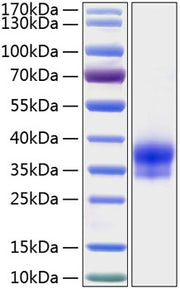 Recombinant Human IGFBP-6 Protein
