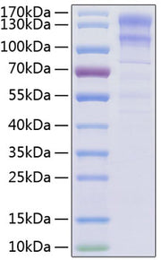 Recombinant Human Low-density lipoprotein receptor/LDLR Protein
