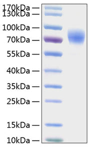 Recombinant Human Thrombopoietin/THPO Protein