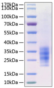 Recombinant Human Flt3 ligand/Flt3L Protein