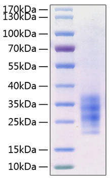 Recombinant Human Flt3 ligand/Flt3L Protein
