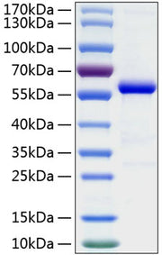 Recombinant Human Ephrin-A5/EFNA5 Protein