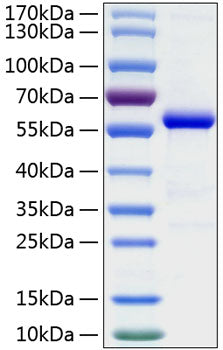 Recombinant Human Ephrin-A5/EFNA5 Protein