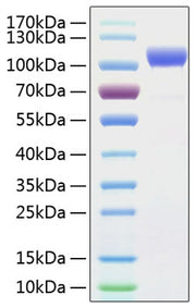 Recombinant Human ErbB-2/HER2/CD340 Protein