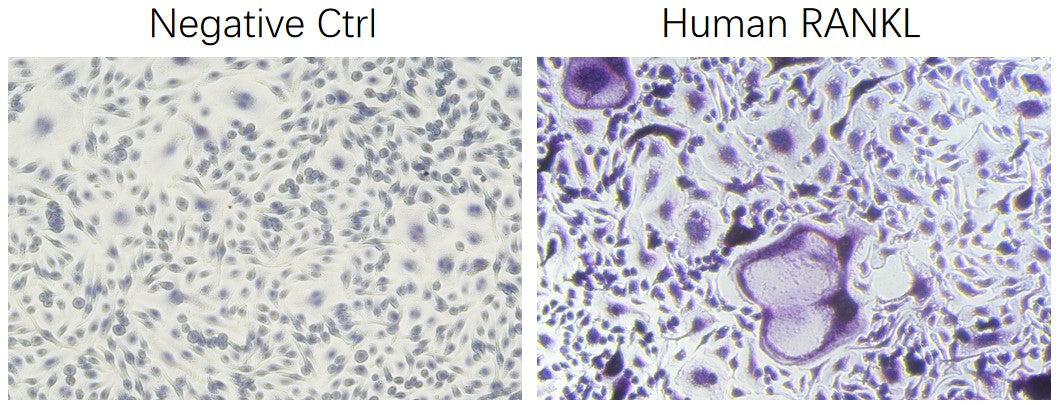 Recombinant Human TNFSF11/RANKL/CD254 Protein