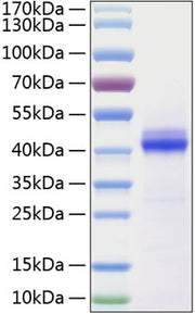 Recombinant Human CD5L Protein