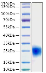 Recombinant Human Cripto-1/TDGF1 Protein
