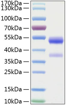 Recombinant Human Angiopoietin-like 7/ANGPTL7(27-346) Protein
