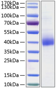 Recombinant Human CD301 Protein