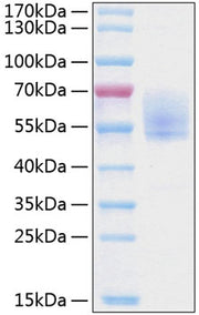 Recombinant Human Podoplanin/PDPN Protein