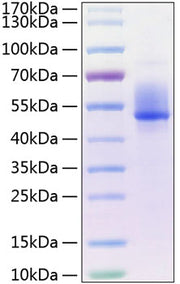 Recombinant Human Dkk-3 Protein