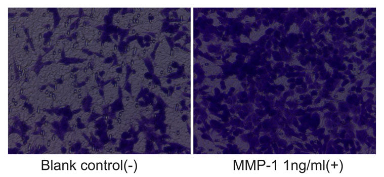 Recombinant Human MMP-1 Protein