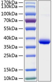 Recombinant Human IGFBP-2 Protein