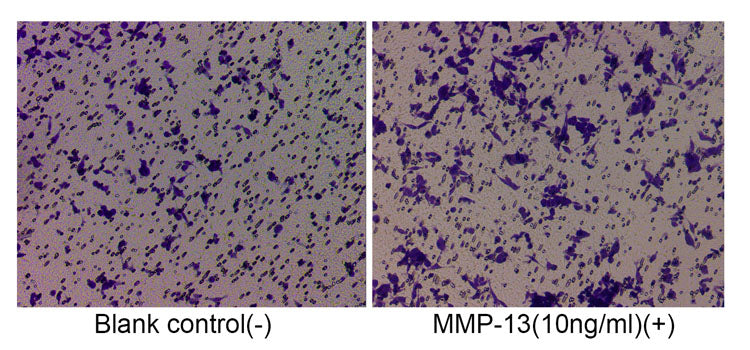 Recombinant Human MMP-13 Protein