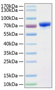 Recombinant Human Alpha-fetoprotein/AFP Protein