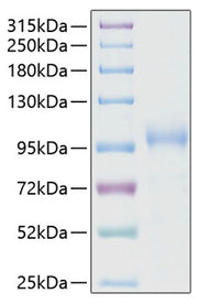 Recombinant Human CDH6/K-Cadherin Protein