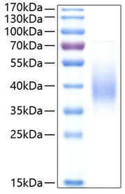 Recombinant Human Fc-epsilon RI-alpha/FCER1A Protein