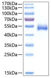 Recombinant Human Chitinase-1/CHIT1 Protein