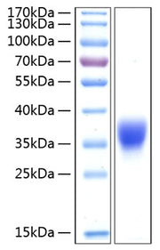 Recombinant Human BTN1A1/Butyrophilin Protein