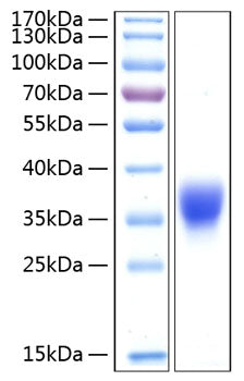 Recombinant Human BTN1A1/Butyrophilin Protein