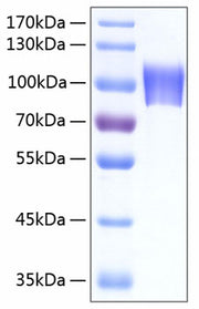 Recombinant Human Neuroligin-4/NLGN4X Protein
