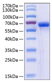 Recombinant Human NKG2D ligand 2/ULBP2 Protein
