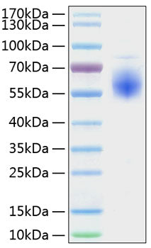 Recombinant Human IL1RL1/ST2 Protein