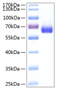 Recombinant Human BTN1A1/Butyrophilin Protein