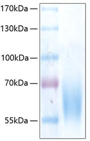 Recombinant Human Trk-B/NTRK2 Protein